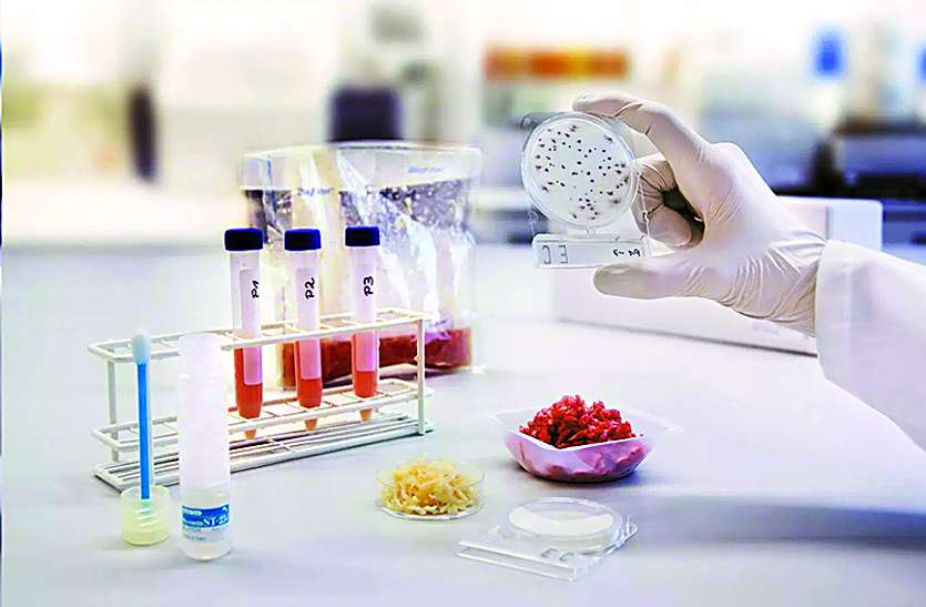 drug test चुनावी साल में नरम पड़ा विभाग, आंकड़ों में सामने आई हकीकत