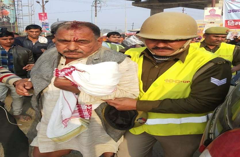 kumbh mela कुंभ में नागा साधुओं ने चिमटे से हमला कर श्रद्दालु का सिर फोड़ा, अस्पताल में शुरू हुआ ईलाज