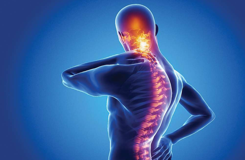 spondylitis-patients-take-care-of-these-things स्पॉन्डिलाइटिस के मरीज इन बातों का रखें खयाल