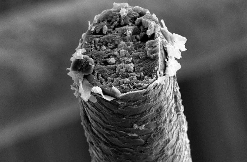 Microscopic image of hair