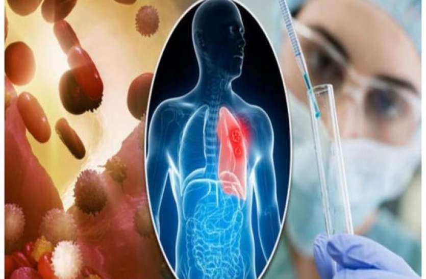 cancer मिल गया कैंसर का इलाज, 4th स्टेज के कैंसर को जड़ से उखाड़ फेंक देगी ये चीज