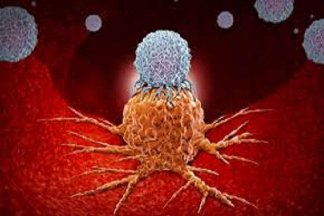 Pancreatic cancer