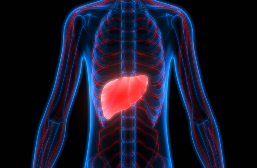 non-alcoholic-fatty-liver-disease शराब न पीने वालों को भी हो सकती है ये घातक बीमारी