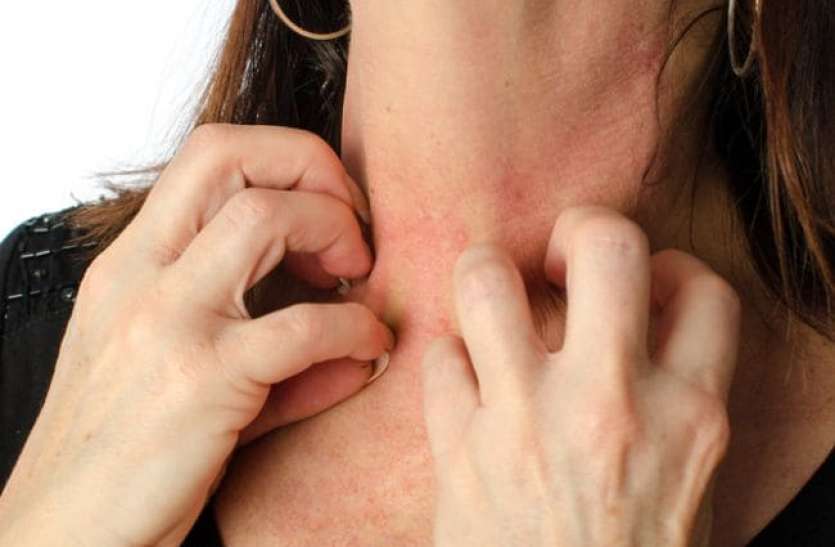 Skin Problems Care Tips In Hindi त ज स फ ल रह ह य र ग कह आप भ इसक ग रफ त म त नह आ गए ख जल स श र ह त ह य पर श न