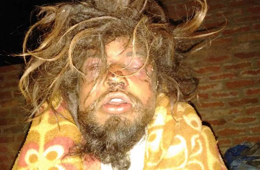 some villager beaten to saint due to praises of the yogi संत की पिटाई मामला : पुलिस ने आरोपों को किया खारिज, कहा- नशे में बाबा ने दीवार पर पटका सिर