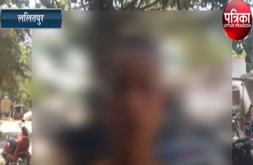 Teachers indecency and beaten student in up शिक्षकों ने अभद्रता कर छात्र को जमकर पीटा, पुलिस कहती है अभी हांथ नहीं टूटा