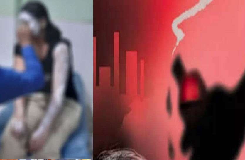 acid attack पत्नी के चरित्र पर पति करता था शक, बेल्ट से मारापीटा और तेजाब फेंका तो झुलस गया यह अंग