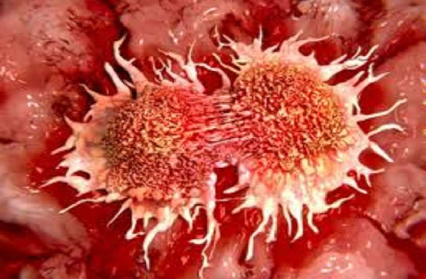 Cancer पुरूष भूलकर भी इन लक्षणों को न करें इग्नोर, हो सकता है कैंसर