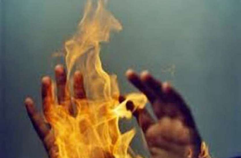 fire नाबालिग प्रेमी ने शादी का दवाब डालने के लिए खुद पर डाला पेट्रोल तो प्रेमिका ने लगा दी आग
