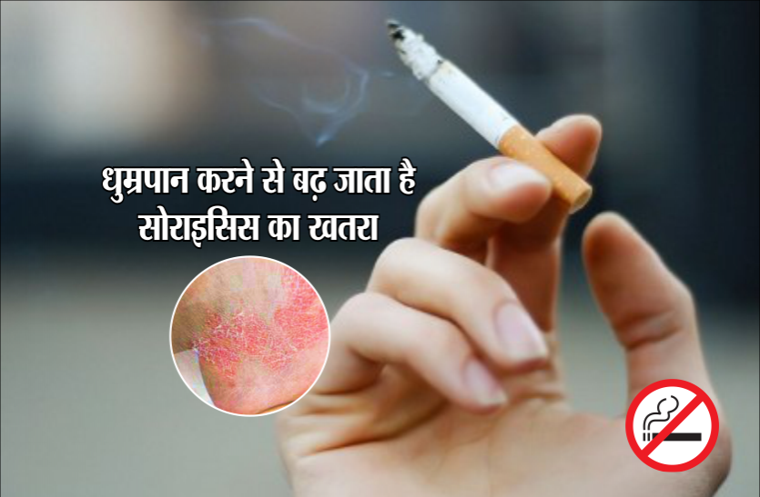health news धुम्रपान करने से बढ़ जाता है सोराइसिस का खतरा, बेहद गंभीर है ये बीमारी