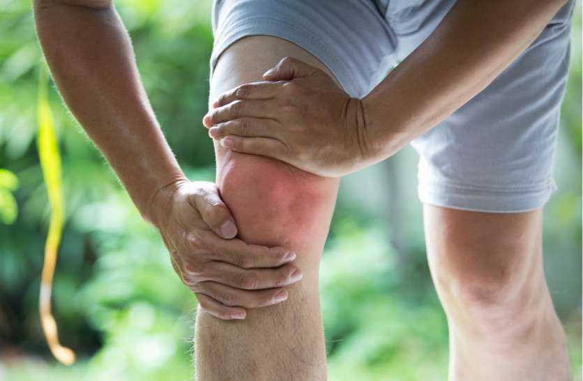 Osteoarthritis ऑस्टियो आर्थराइटिस में कारगर है होम्योपैथी