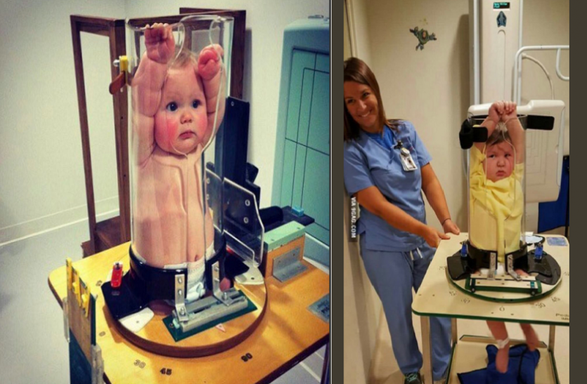 Pigg O Stat method of X ray of babies photos went viral ऐसे होता है छोटे बच्चों का एक्स-रे, तरीका जान हंसते-हंसते पेट में होने लगेगा दर्द