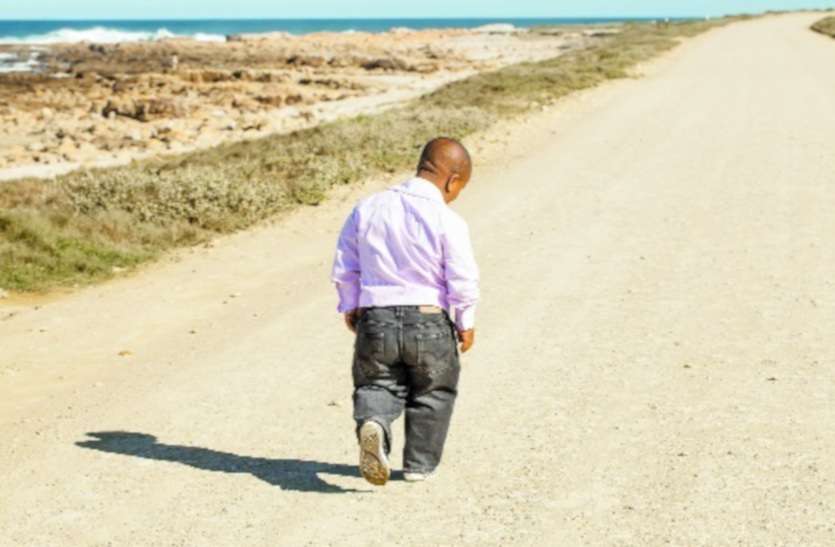 Dwarfism लाइलाज नहीं है बौनापन