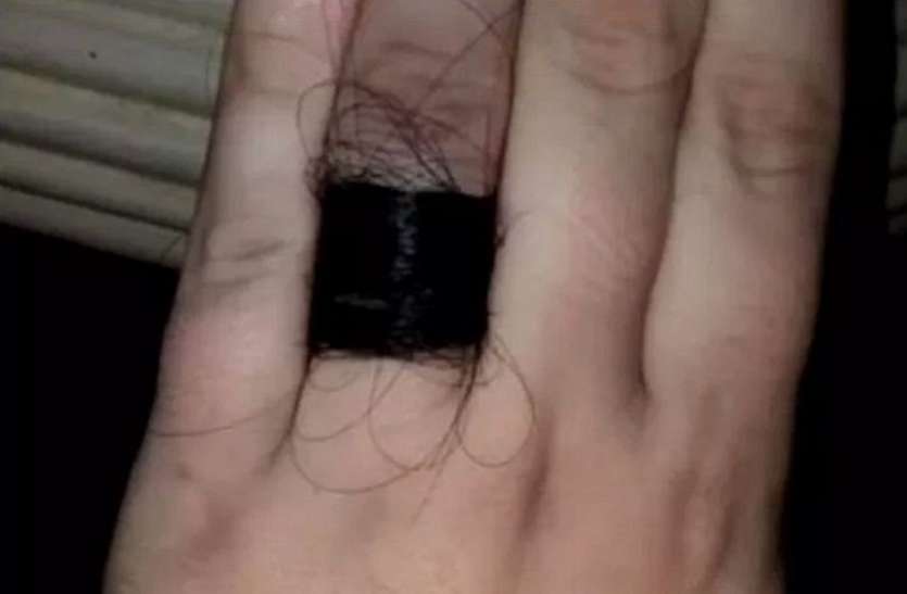 woman confirms engagement but people are horrified to see the pic पागलपन की हद पार कर गया ये शख्स, गर्लफ्रेंड को पहनाई ऐसी अंगूठी, लोगों को आ रही घिन