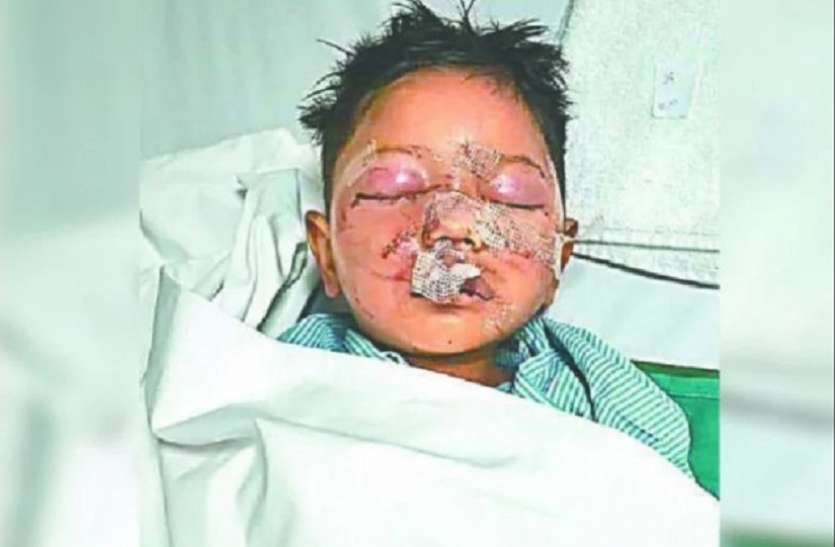 Ghaziabad police नर्सरी में लहूलुहान मिला 4 साल का मासूम, बोला- मुझे बचा लो अंकल, पहचानने में कीजिए मदद