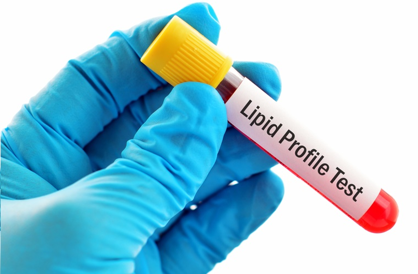 Know About Lipid Profile Test - जानिए क्यों कराया जाता है लिपिड प्रोफाइल  टैस्ट | Patrika News