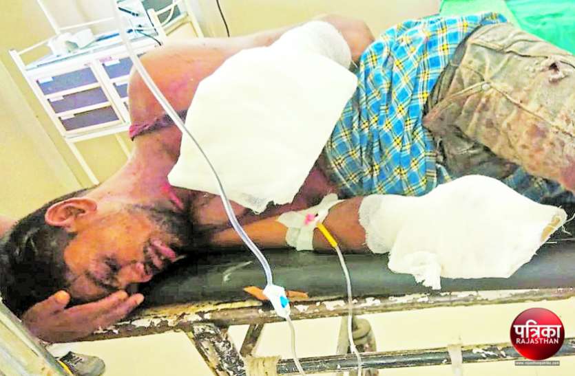 banswara बांसवाड़ा : मकान बनाने के लिए पत्थर तोड़ते समय बारूद फटा, दर्दनाक हादसे में युवक के दोनों हाथों की अंगुलियां उड़ी और...