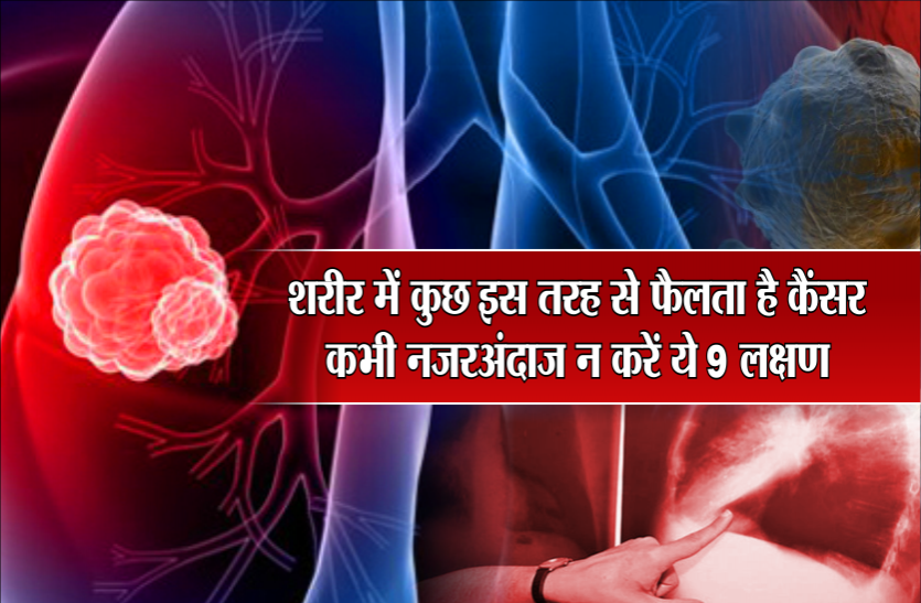 cancer symptoms शरीर में कुछ इस तरह से फैलता है कैंसर, कभी नजरअंदाज न करें ये 9 लक्षण