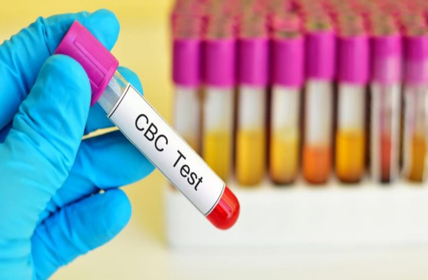 know-about-complete-blood-count-cbc सीबीसी: एक खून की जांच बताती है कई बीमारियों के बारे में