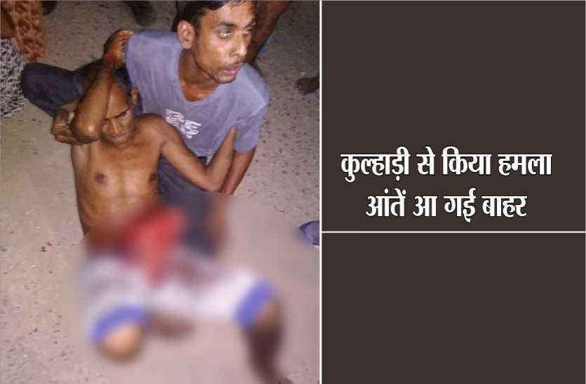 police team par hamla sidhi old man Attack with ax कुल्हाड़ी से किया हमला, आंतें आ गई बाहर, पुलिस ने किया बीच-बचाव तो ग्रामीण बोले हम देंगे सजा, आगे जानिए