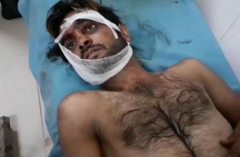 premi प्रेमिका से प्रेम का इजहार करना युवक को पड़ गया भारी, हुई कुछ ऐसी हालत कि पड़ गए लेने के देने, देखें वीडियो