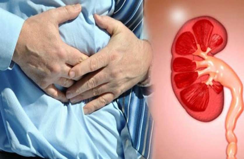 kidney stones किडनी स्टोन से बचाते ये खास नुस्खे