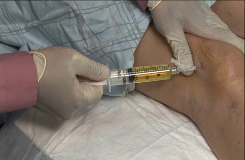 know-about-joint-fluid-analysis जोड़ों में दर्द रहता है तो जानिए जॉइंट फ्लूड एनालिसिस के बारे में