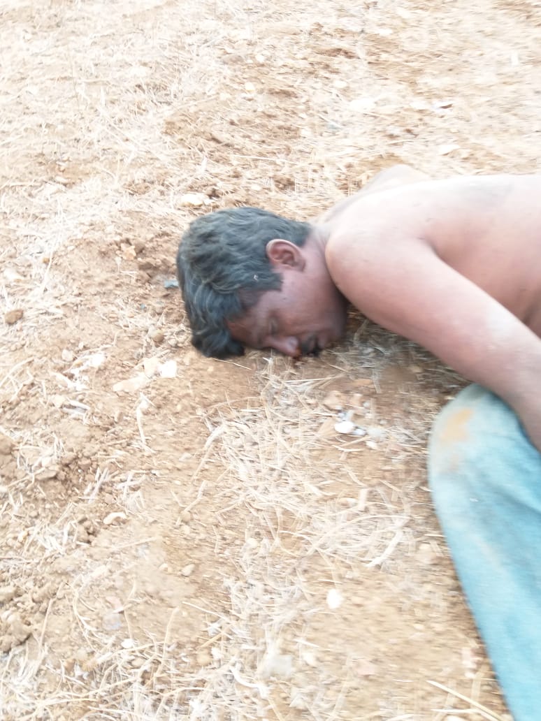 sun strock गर्मी में रहे सावधान, सन स्ट्रोक से हो रही मौत
