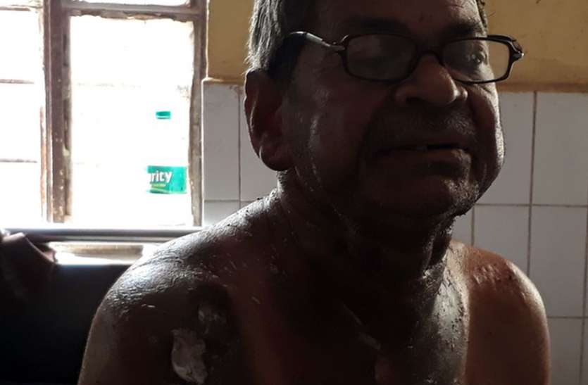 hindaun karauli news ओएमजी दुक़ान खाली कराने के लिए किरायेदार पर तारपीन का तेल उड़ेल लगाई आग, लोगों की तत्परता से बच गई जान