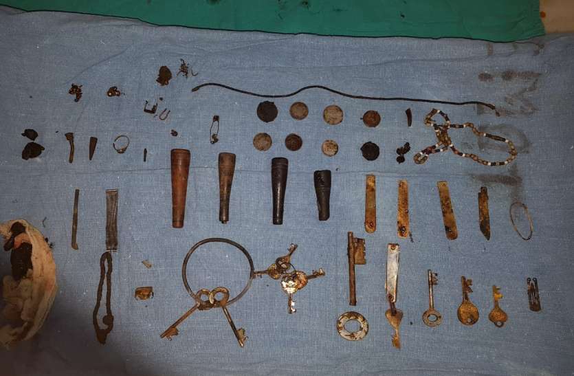 The items of iron derived from the stomach of the drug addict पढ़े ऐसे शख्स की कहानी जो बरसों से पेट में आरी पत्ता, चिलम, नेल कटर, चाबियां व सिक्के लेकर घूम रहा था