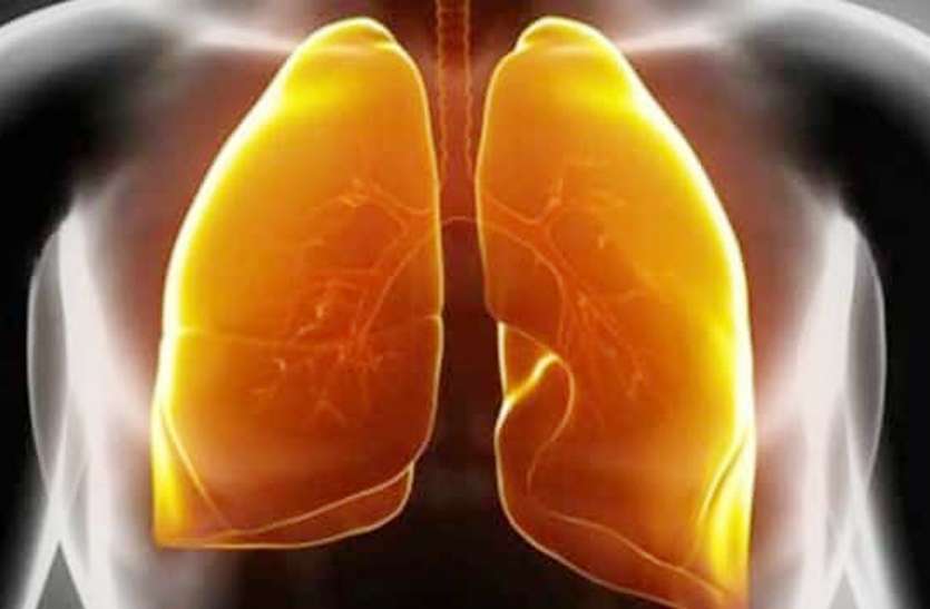 health news Health News: खानपान में भूलकर भी न करें इन 5 चीजों का अत्यधिक सेवन, फेफड़ों पर पड़ सकता है बुरा असर