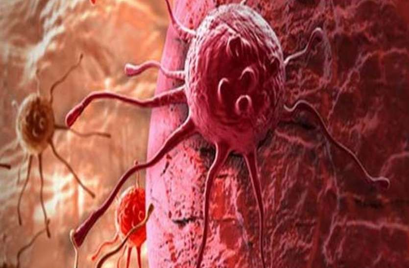 Cancer, taking away life like Amarbail, health department अमरबेल की तरह जिंदगियों को आगोश में ले रहा कैंसर, आंकड़ों से दूर स्वास्थ्य विभाग