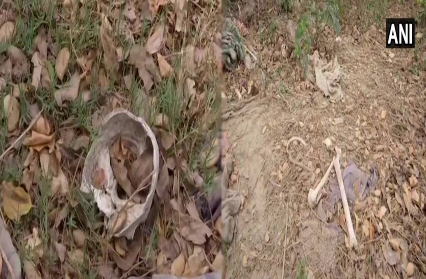 Muzaffarpur Human Skeleton Case मुजफ्फरपुर नर कंकाल मामला: पहले भी कई बार निकले हैं बिहार में नर कंकाल,इस बार 'चमकी बुखार' ने मामला चमका दिया!