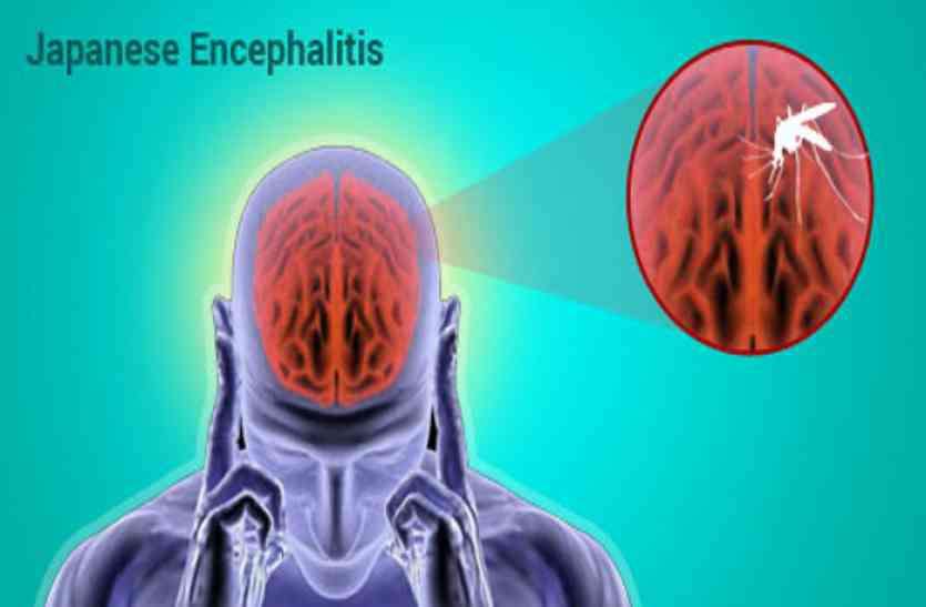 1 more child has symptoms of Japani Encephalitis in bastar, बकावंड ब्लॉक के दामागुड़ा में 1 बच्चें में दिखे जापानी बुखार के लक्षण, इधर दरभा को भी लिया चपेट में