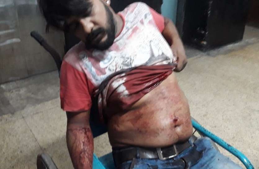 kolkata mother firiing on son who qurrel his wife : बहू को गाली देने पर पुत्र को मारी गोली, मां गिरफ्तार