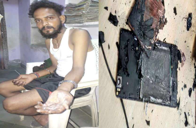 mobile beeeetry burst in bhilwara जेब में रखे मोबाइल की बेेेेट्री फटी, युवक झ्ाुुुलसा