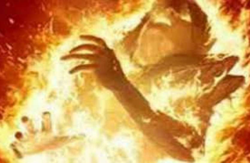 burn पड़ोसियों के ताने से तंग आकर किशोरी ने लगायी आग, हालत गंभीर