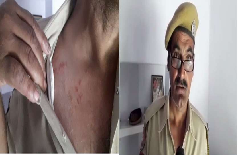 police beating case in japur बदमाशों और पुलिसकर्मियों के बीच हुई मारपीट, पकड़ने के बावजूद दबाव में पुलिस ने बदमाशों को छोड़ा