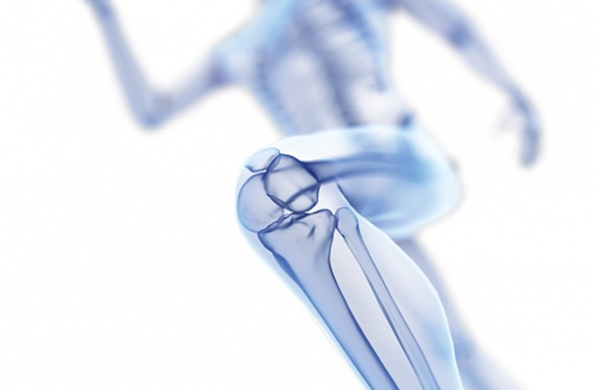 stromal vascular fraction जोड़ों के इलाज में कारगर है एसवीएफ पद्धति