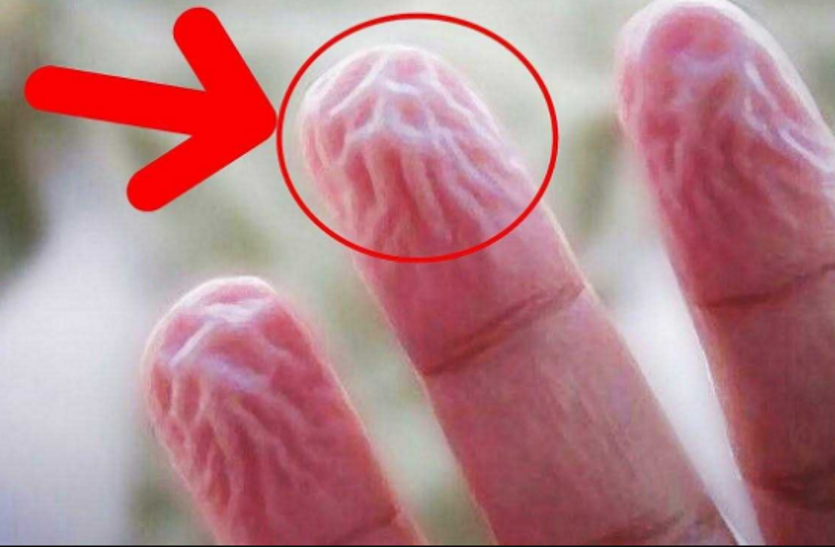 finger shrinking news hindi बारिश में भीगने के बाद अगर आपके हाथ भी हो जाते हैं ऐसे, तो जरूर पढ़े ये खबर