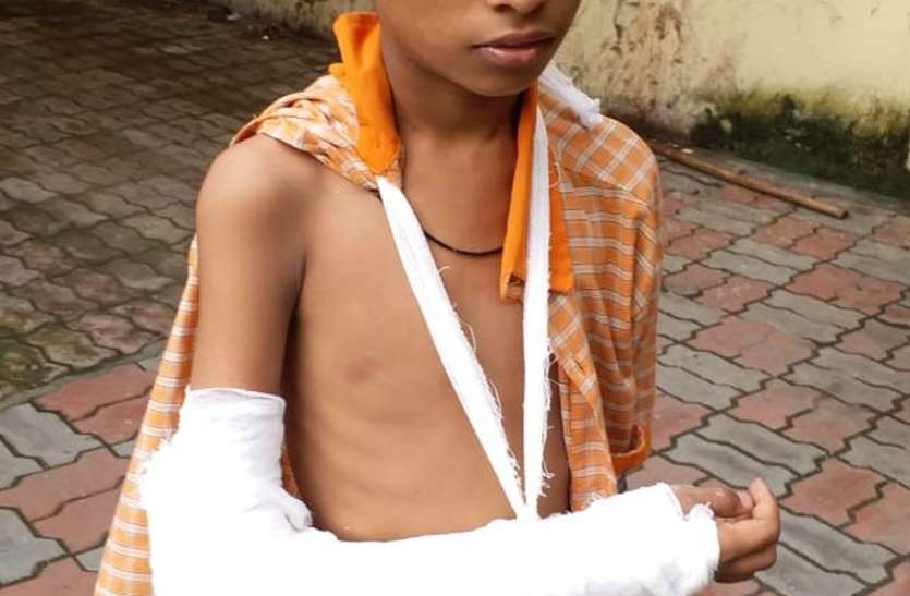 surat photo Surat News शिक्षक की पिटाई से छात्र का हाथ टूटा