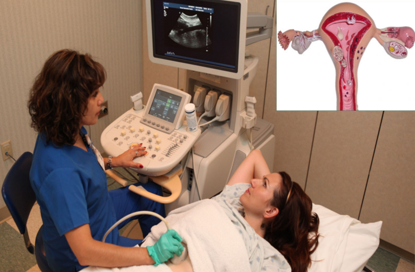 uterine-cancer-learn-how-to-identify-uterine-cancer-in-firs-stage uterine cancer: जानें पहली स्टेज में कैसे पहचानें गर्भाशय कैंसर के बारे में