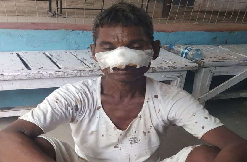 police, Revenge, hostility, controversy, tribal zones, latest Hindi news, Ratlam news एमपी में गजब कारनामा, लड़ाई में काट दी दांत से नाक