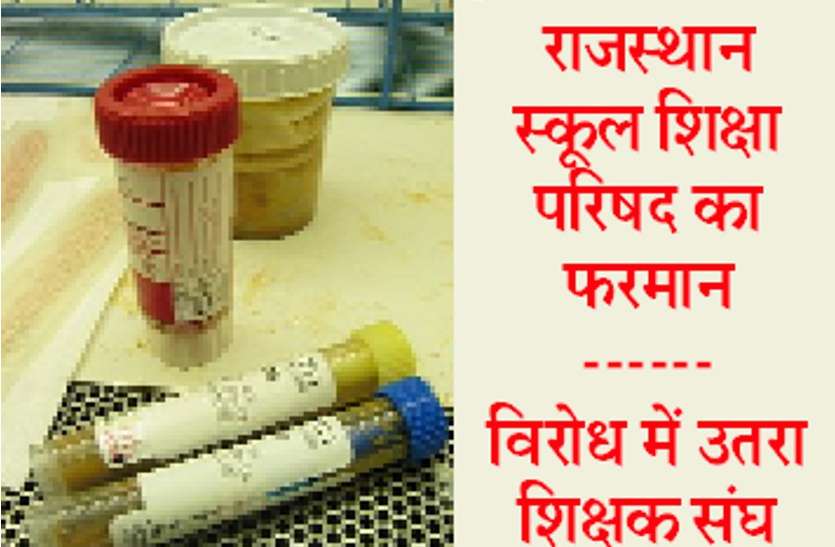 Stools samples राजस्थान सरकार का फरमान, अब बच्चों के मल का सैंपल लेंगे शिक्षक, विरोध में उतरे शिक्षक