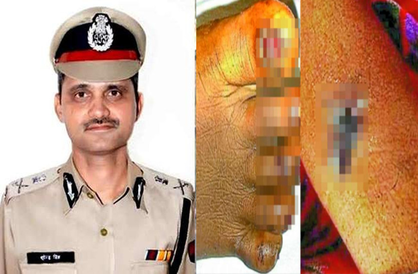 RAJASTHAN CRIME प्रदेश में हो रहे अपराधों पर DGP से पत्रिका की बातचीत, सरदारशहर मामले पर बोले- पीड़ित परिवार से क्षमा प्रार्थी