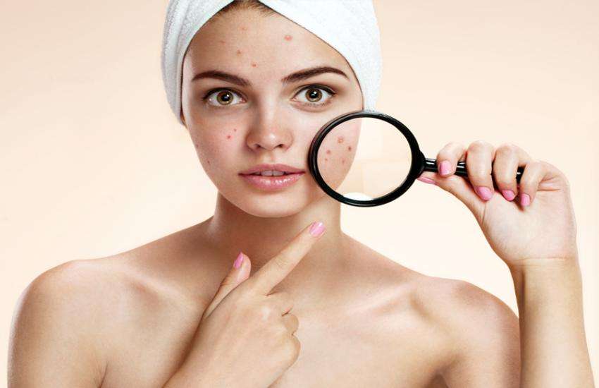 skin problems