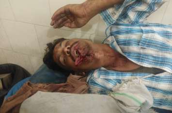 Goat was grazing the young man, attacked the bear बकरी चराने गया था युवक, भालू ने कर दिया हमला
