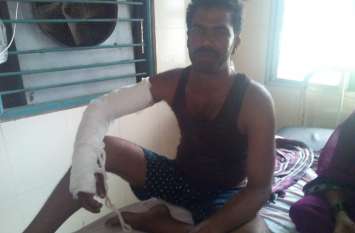 Crime in Ambikapur : Rod attack and looted 20 thousand by 4 ruffian 4 बदमाशों ने दिनदहाड़े बाइक सवार युवक पर किया रॉड से हमला, लूट लिए 20 हजार, थाने पहुंचते ही हुआ बेहोश फिर...