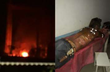 Four employees burnt by fire in electrical sub station दहशत के पल: तेज धमाके के साथ आग के शोलों में बदल गया सबस्टेशन, चार कर्मचारी गंभीर रूप से झुलसे, इस वजह से हुआ हादसा