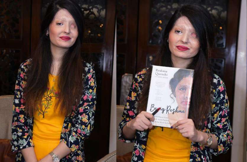 Reshma Qureshi Acid attack की शिकार रेशमा कुरैशी का पीड़िताओं को संदेश, बोलीं अपनी शक्ल को छिपा कर अपराधियों को जीतने मत देना...